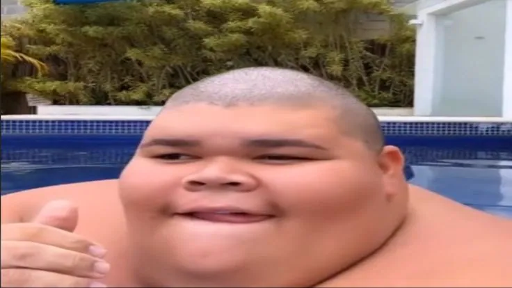 menino careca sorrindo na piscina
